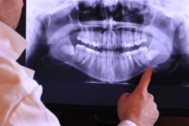 Best Urgent Care for Lost Fillings or Crowns in Fruitland Park, FL
